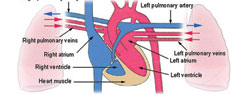 Hipertensión arterial pulmonar Clasificación y terapia