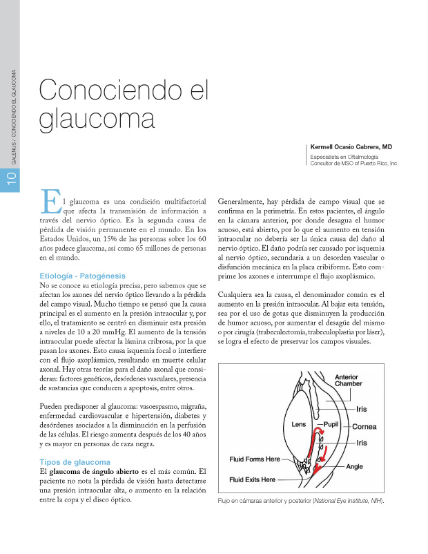 Conociendo el glaucoma