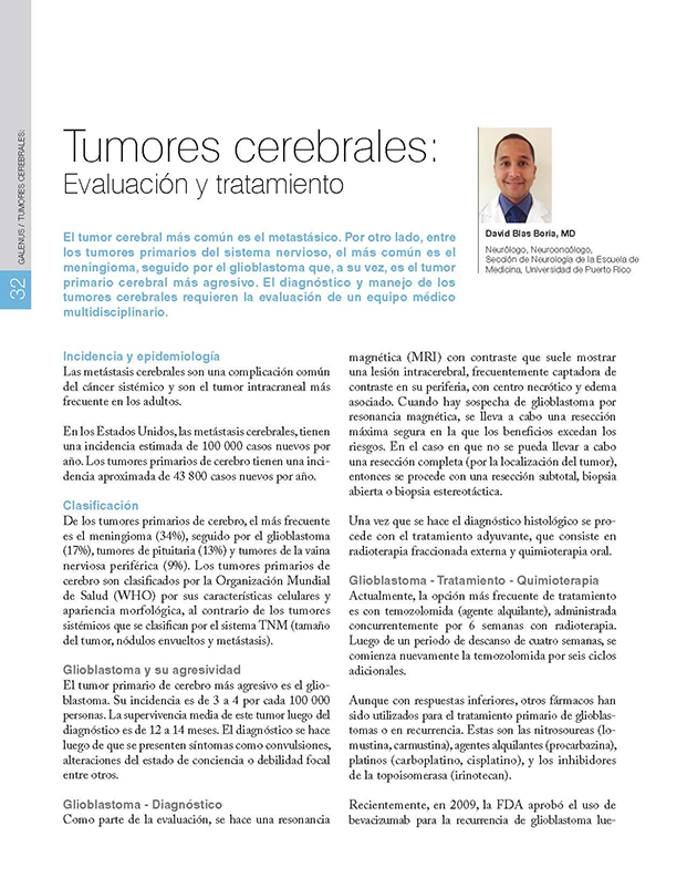 Tumores cerebrales:  Evaluación y tratamiento