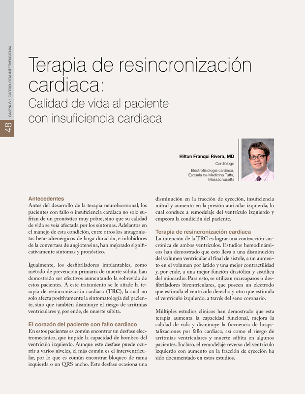 Terapia de resincronización cardiaca: Calidad de vida al paciente con insuficiencia cardiaca