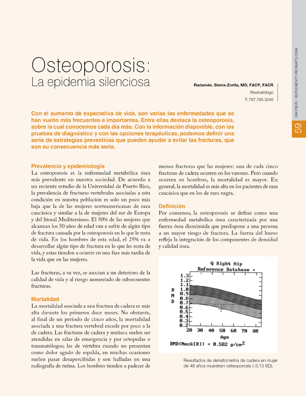 Osteoporosis: La epidemia silenciosa