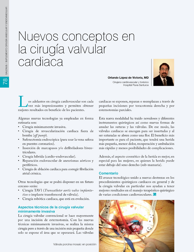 Nuevos conceptos en la cirugía valvular cardiaca