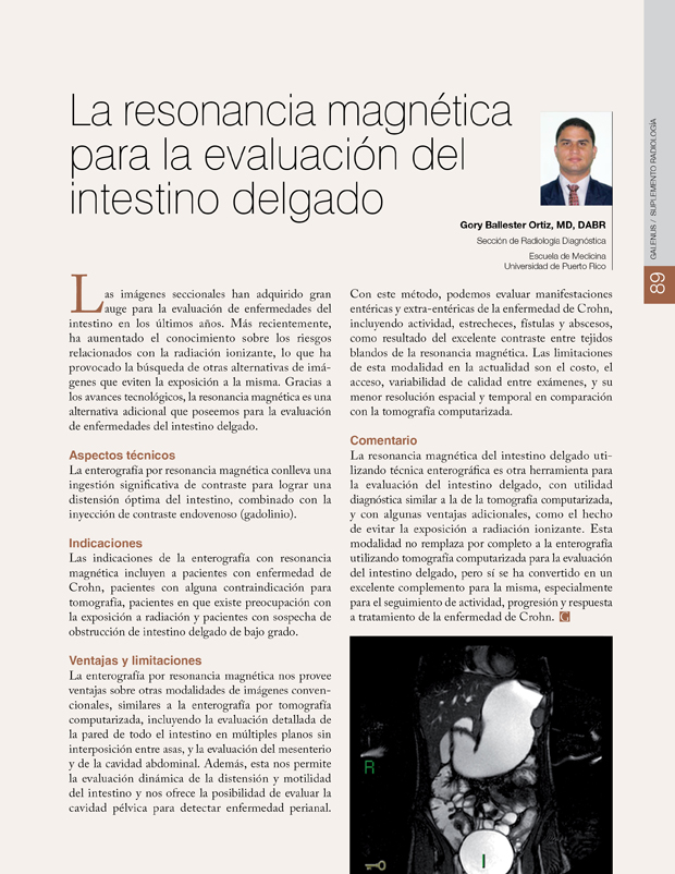 La resonancia magnética para la evaluación del intestino delgado