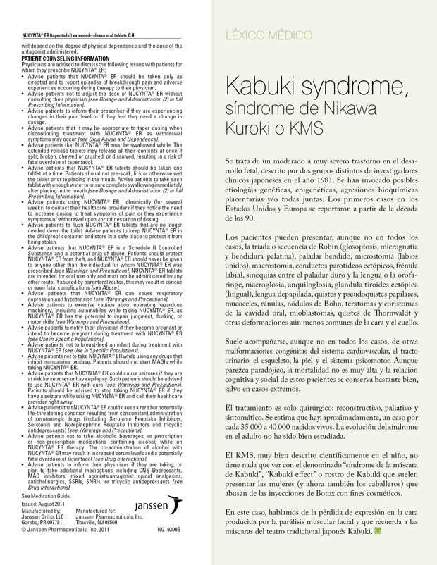 Kabuki syndrome, síndrome de Nikawa Kuroki o KMS