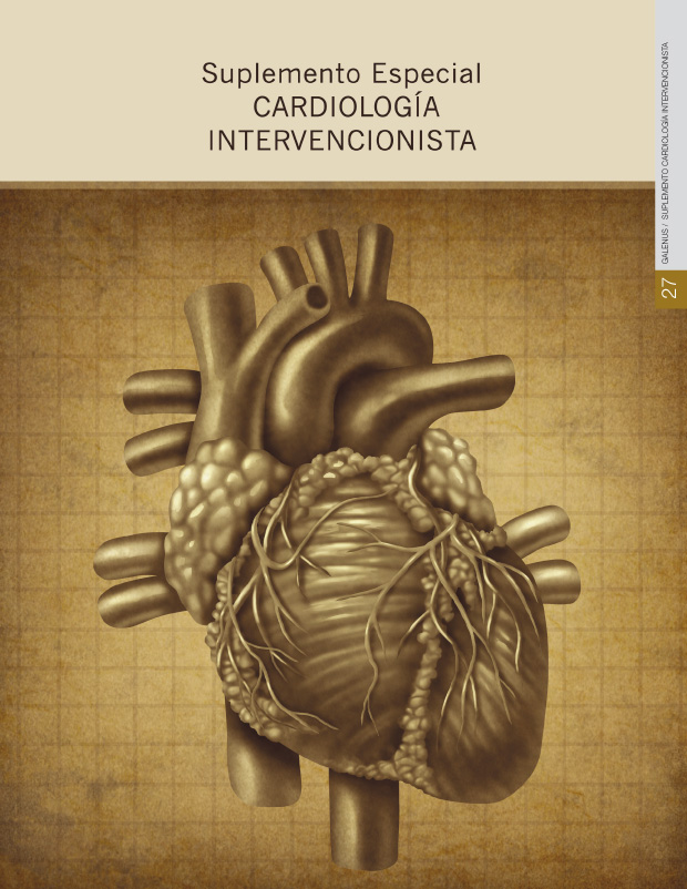 Suplemento Cardiología Intervencionista