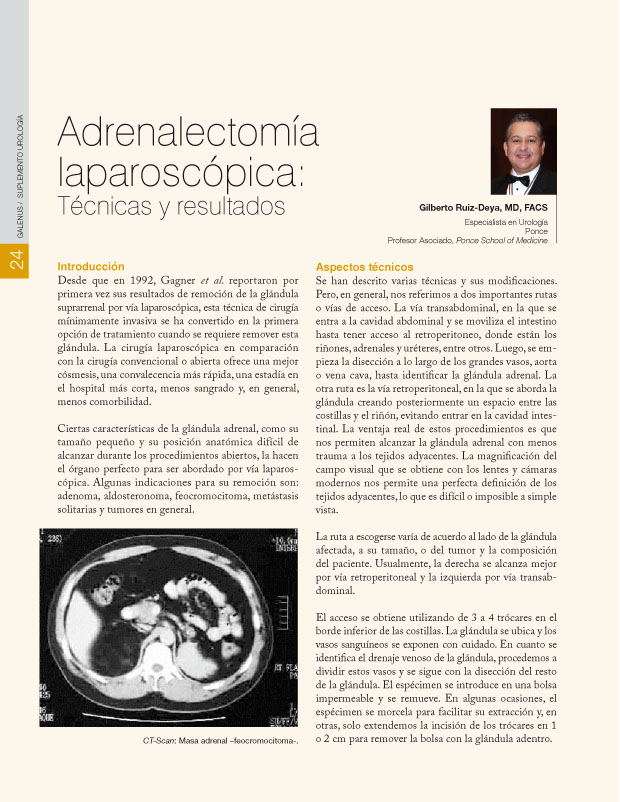 Adrenalectomía laparoscópica: