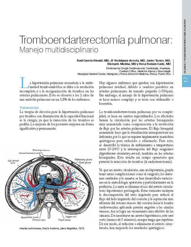 Tromboendarterectomía pulmonar: Manejo multidisciplinario