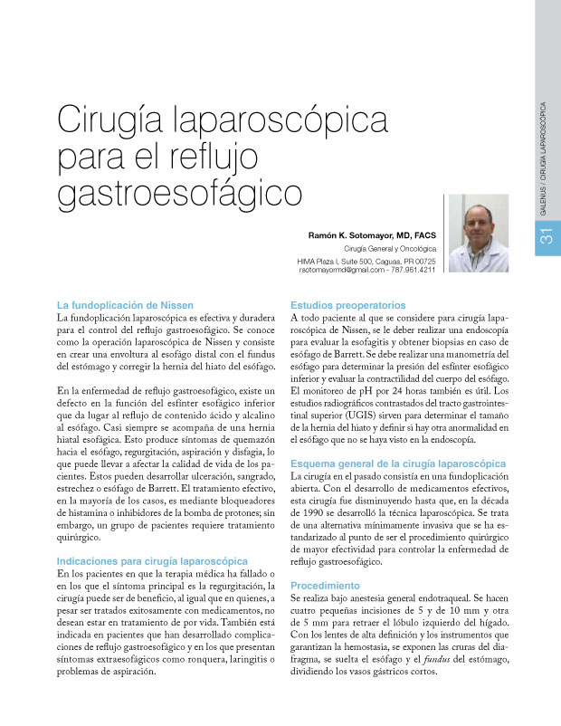 Cirugía laparoscópica para el reflujo  gastroesofágico