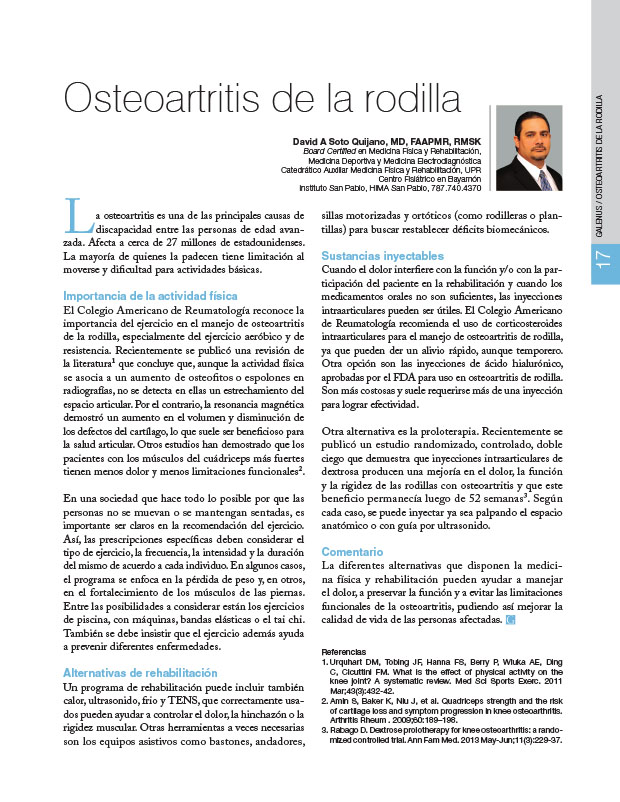 Osteoartritis de la rodilla