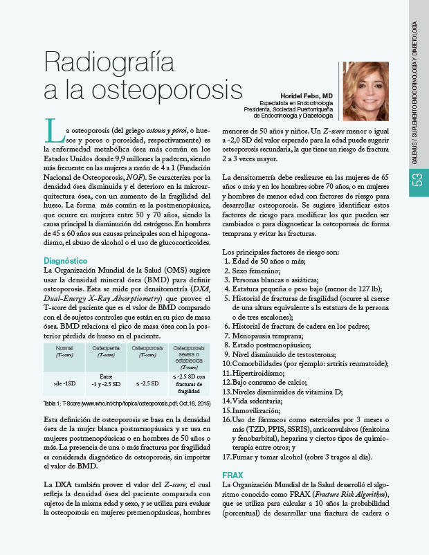 Radiografía a la osteoporosis