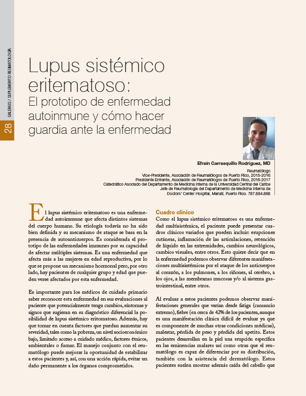 Lupus sistémico eritematoso: El prototipo de enfermedad autoinmune y cómo hacer guardia ante la enfermedad