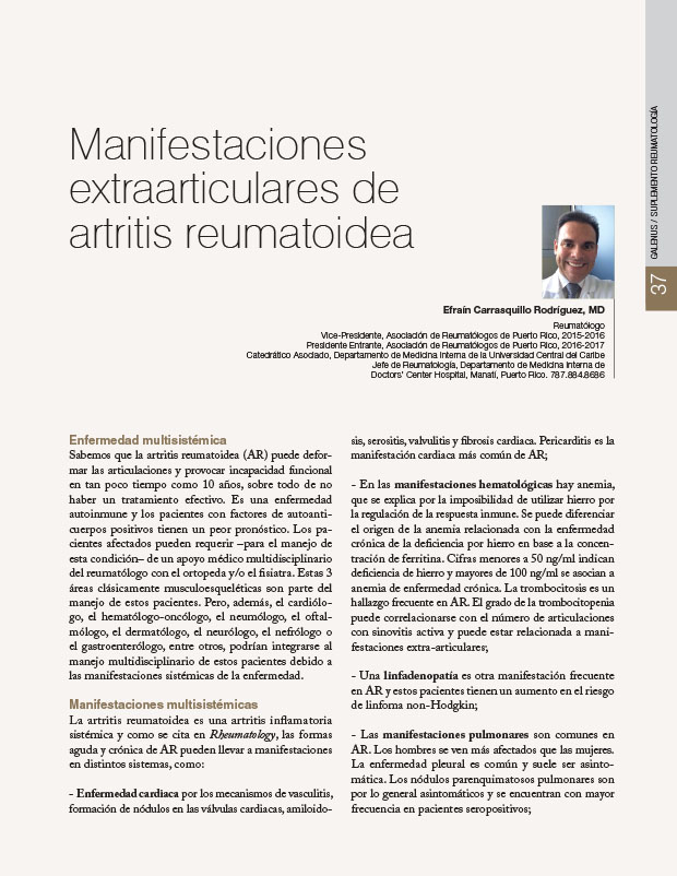 Manifestaciones extraarticulares de artritis reumatoidea