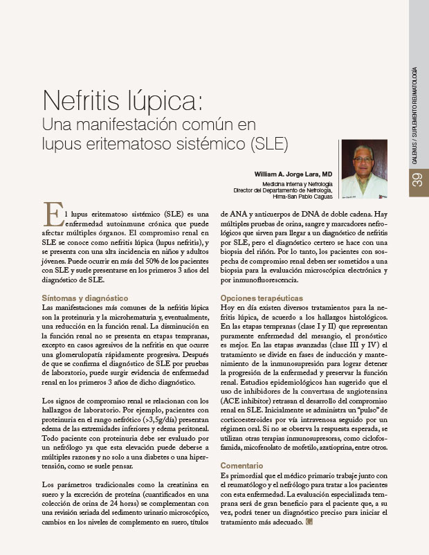 Nefritis lúpica: Una manifestación común en lupus eritematoso sistémico (SLE)