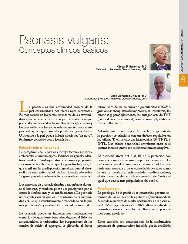 Psoriasis vulgaris: Conceptos clínicos básicos
