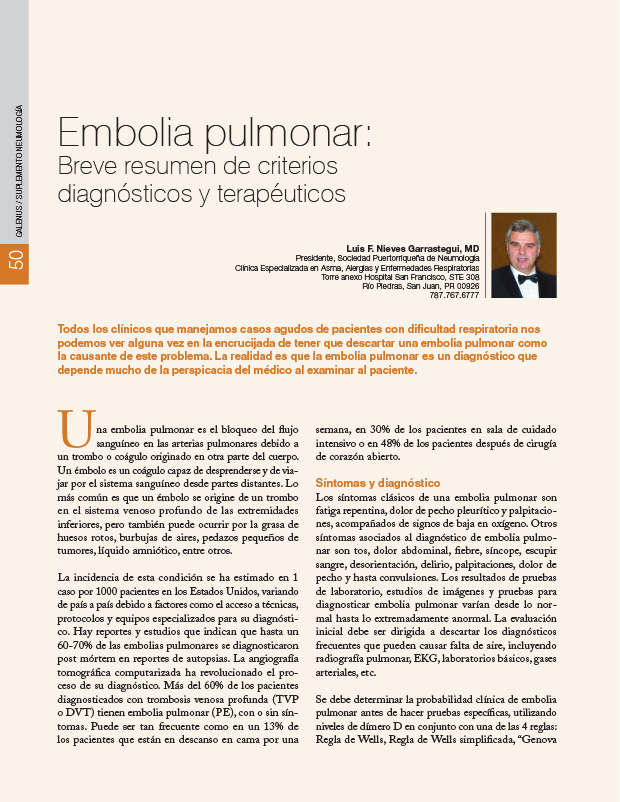 Embolia pulmonar: Breve resumen de criterios diagnósticos y terapéuticos