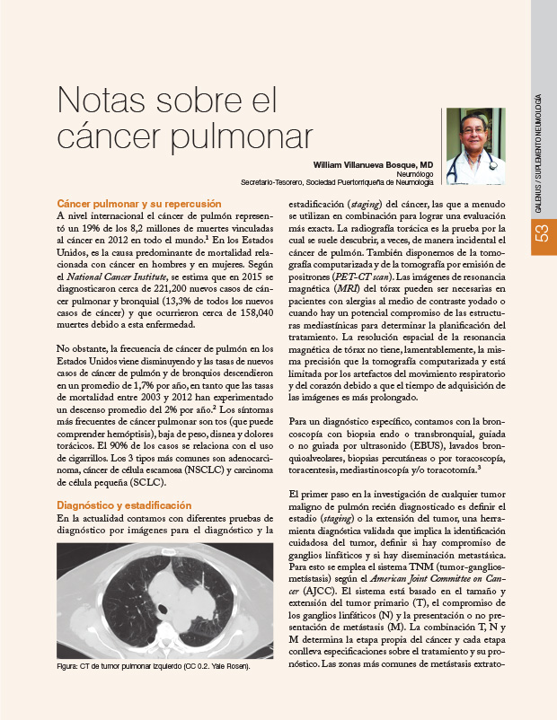 Notas sobre el cáncer pulmonar