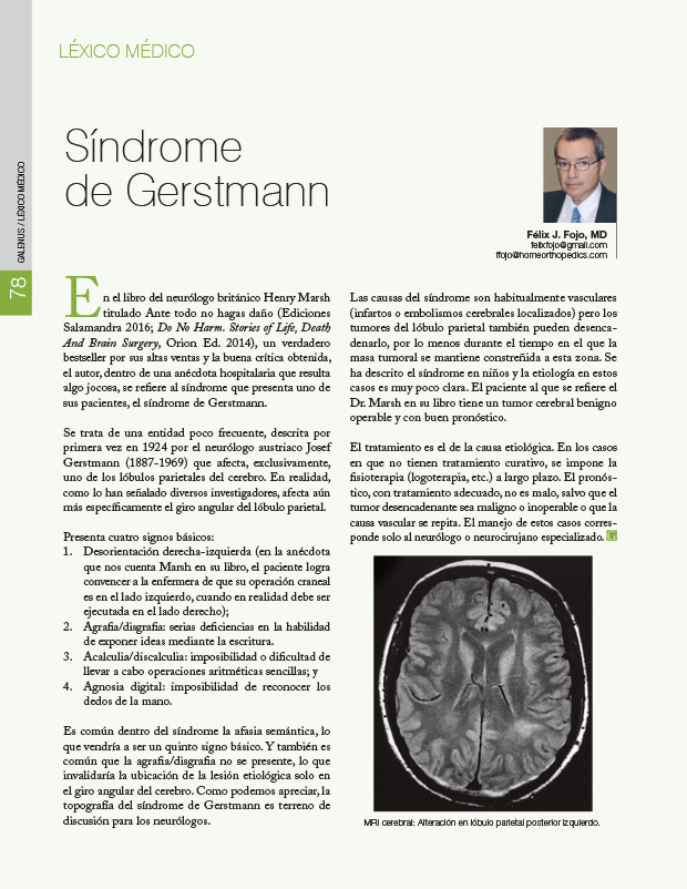 Léxico médico: Síndrome de Gerstmann