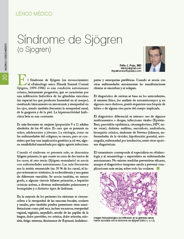 Síndrome de Sjögren (o Sjogren)