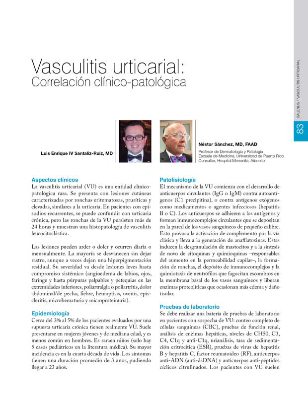 Vasculitis urticarial