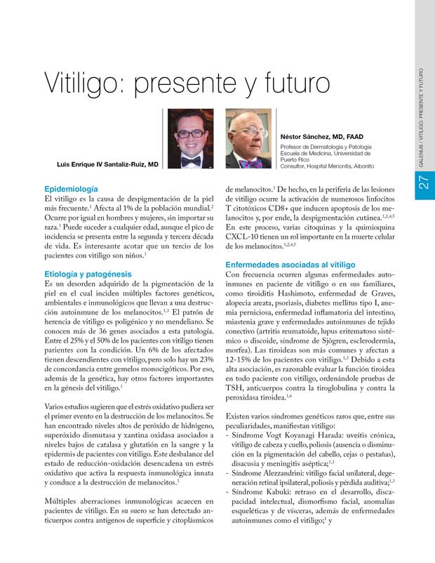 Vitiligo: presente y futuro